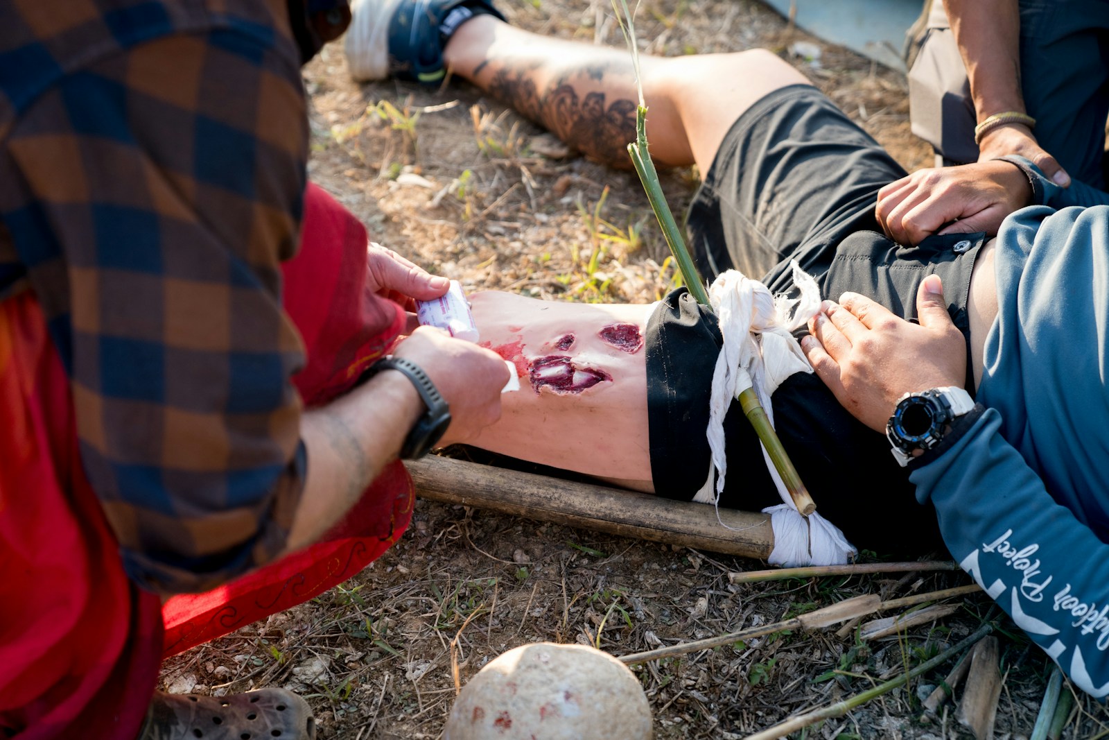A man laying on the ground with a broken leg